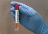 El Municipio emite el informe sobre la pandemia Dio negativo uno de los casos sospechados de coronavirus