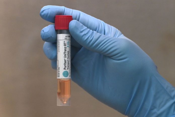 Dio negativo uno de los casos sospechados de coronavirus Dio negativo uno de los casos sospechados de coronavirus