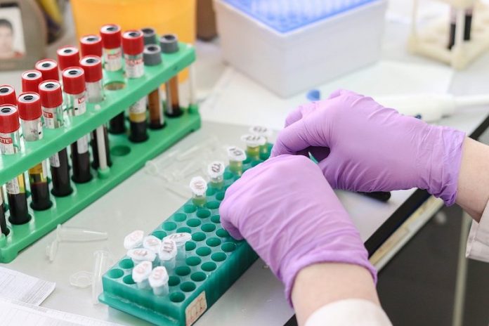 This-simple-blood-test-can-predict-severity-of-COVID-19-